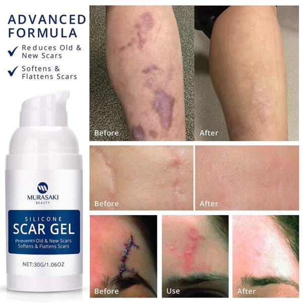 100% Silicone Scar Gel Scar Cream - Advanced Scar Gel for Surgical - Image 3