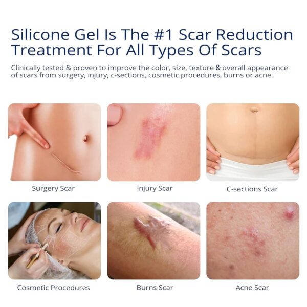 100% Silicone Scar Gel Scar Cream - Advanced Scar Gel for Surgical - Image 2